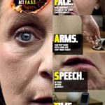 Featured image for ‘Act FAST’ if you recognise stroke signs