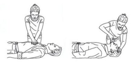 CPR